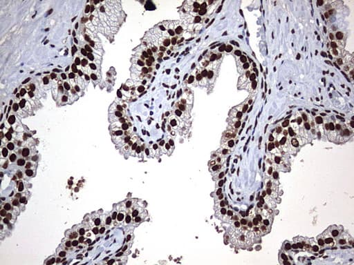 HNRPM / HNRNPM Antibody (aa1-261, clone OTI1E12)
