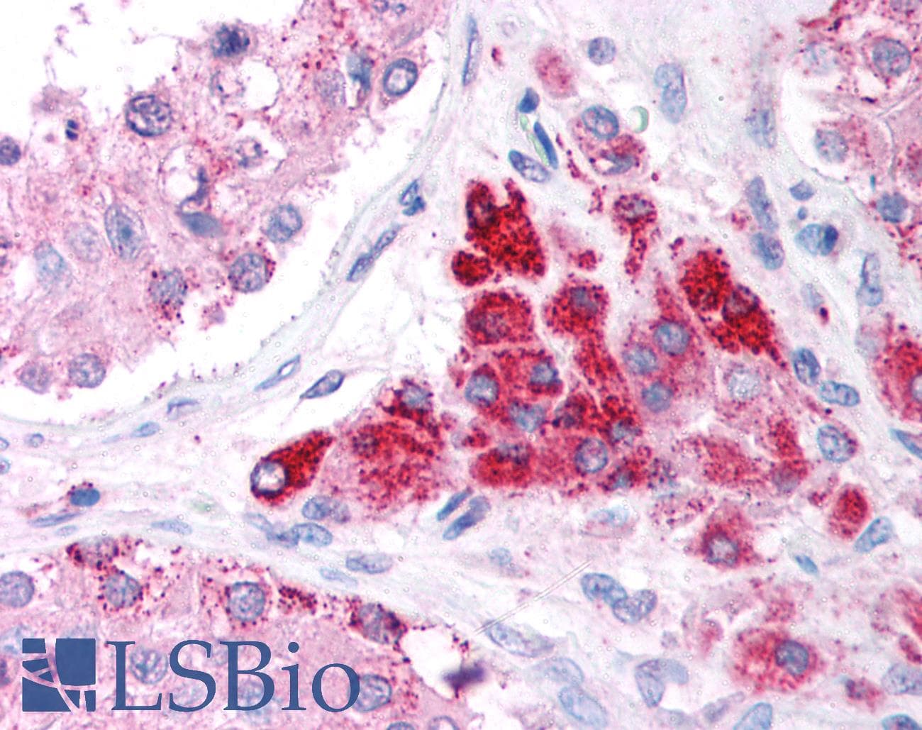 DAP-5 / EIF4G2 Antibody (aa766-815)