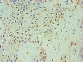 Polyclonal Rabbit anti-Human TBL1XR1 / TBLR1 Antibody (aa1-180, IHC, WB)