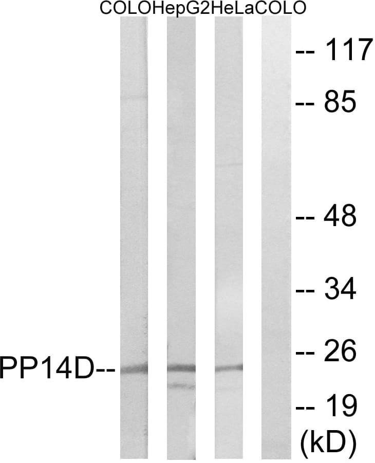 Polyclonal Rabbit anti-Human PPP1R14D / CPI17-Like Antibody (aa66-115, WB)
