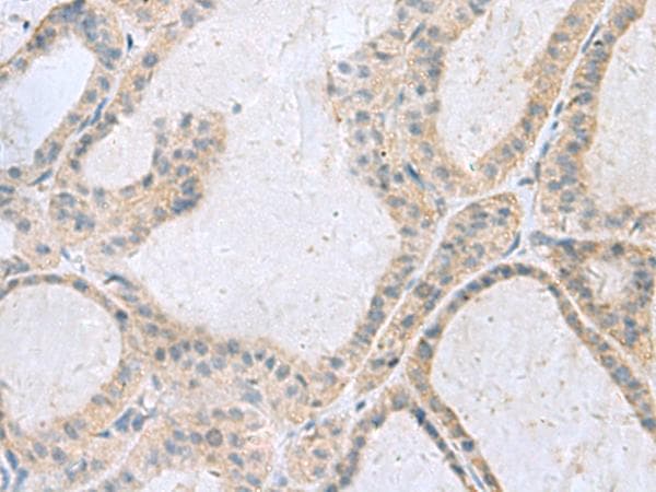 Polyclonal Rabbit anti-Human GINS3 Antibody (IHC)