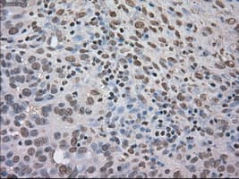NTRK3 / TRKC Antibody (clone OTI2B8)