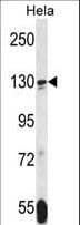 TNKS / Tankyrase Antibody (aa55-82)