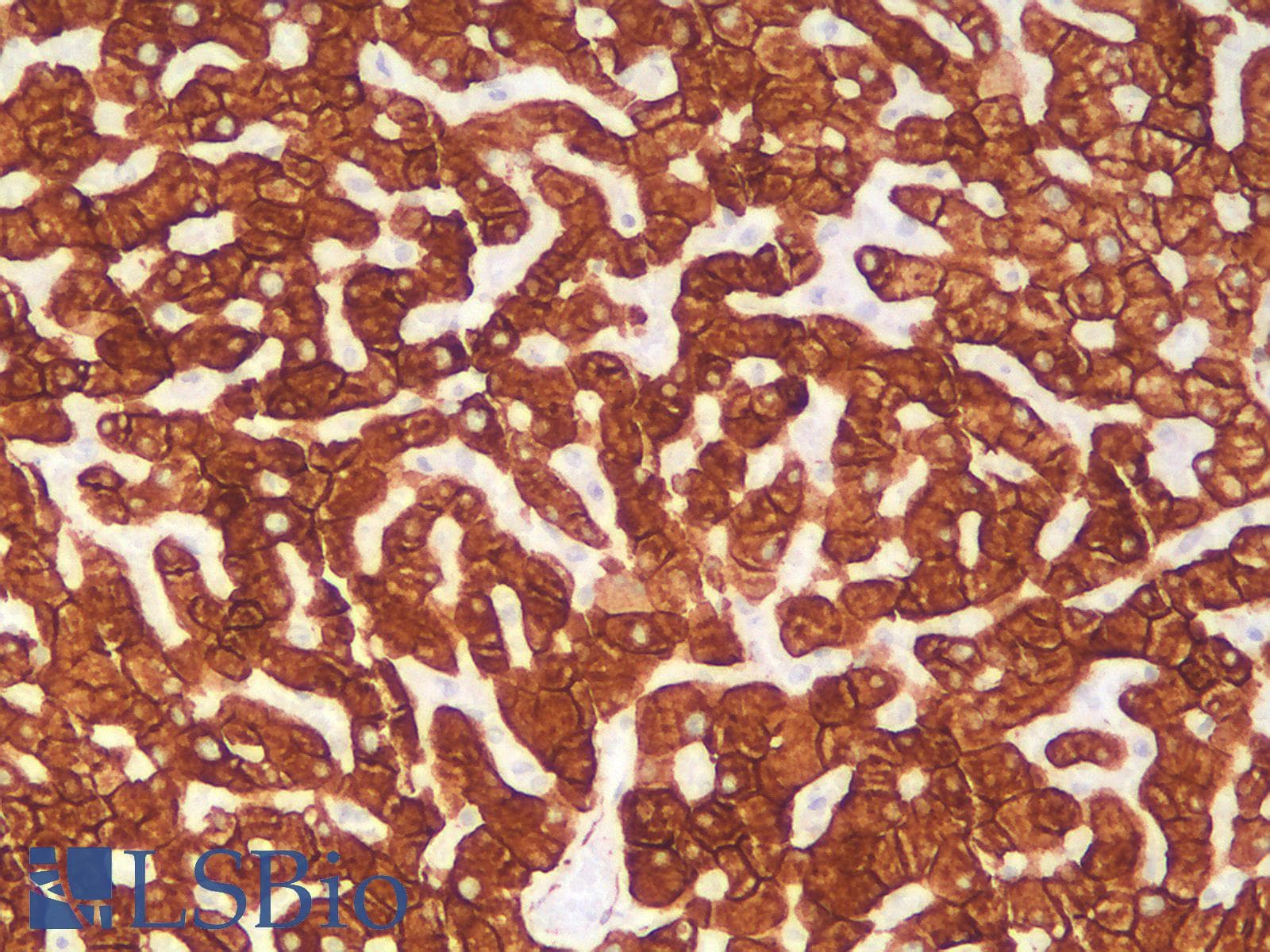 PathPlus™ Recombinant Monoclonal Rabbit anti-Human KRT18 / CK18 / Cytokeratin 18 Antibody (clone KRT18/2808R, IHC, IF, WB)