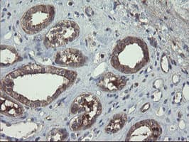 COMMD1 Antibody (clone OTI3B3)
