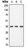 LAT Antibody (phospho-Tyr255)