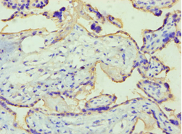 PLAP / Alkaline Phosphatase Antibody (aa260-520)