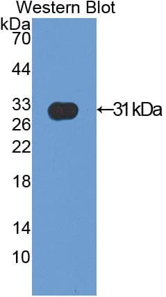 ACTN2 Antibody (aa1-254)