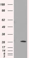 TPMT Antibody (clone OTI2A2)