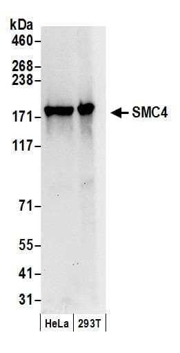 Polyclonal Rabbit anti-Human SMC4 Antibody (aa600-650, IF, WB)