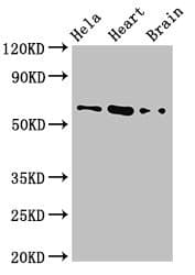 BAIAP2 / IRSP53 Antibody