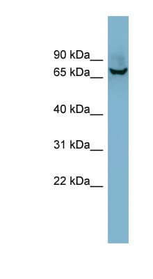 ACHE / Acetylcholinesterase Antibody (aa179-228)