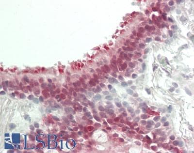IHC-plus™ ZNF496 / NZIP1 Antibody (N-Terminus)