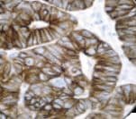 Cytokeratin 8+18 Antibody (clone B22.1 & B23.1, Ready-to-Use)