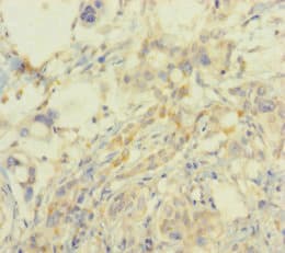 SMARCA2 / BRM Antibody (aa700-1216)