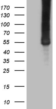 ASS1 / ASS Antibody (C-Terminus, clone OTI8H4)
