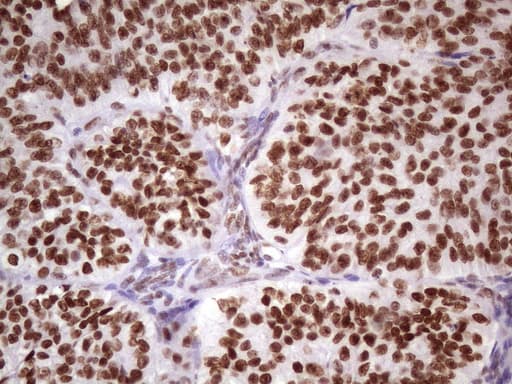 NUDT21 Antibody (aa2-227, clone OTI13H1, Carrier-free)