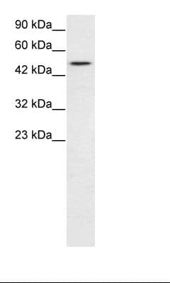 Polyclonal Rabbit anti-Human TBX19 / TPIT Antibody (N-Terminus, IHC, WB)