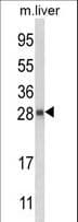 Polyclonal Rabbit anti-Human QDPR / DHPR Antibody (aa218-243, IHC, WB)