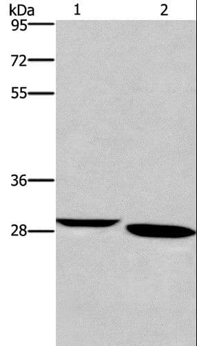 NRG1 / Heregulin / Neuregulin Antibody (aa 90-103 isoform 1)