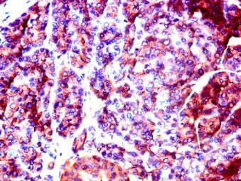 SLC37A2 Antibody