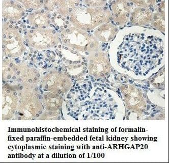 ARHGAP20 Antibody (aa526-729)