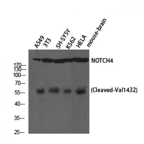 Polyclonal Rabbit anti-Human NOTCH4 Antibody (1370-1450 aa, C-terminal, WB)