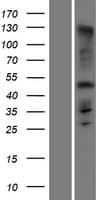 C1orf228 Protein (Over-Expression Lysate Myc-DDK (Flag))