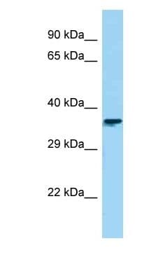 CTBS / CTB Antibody (aa253-302)