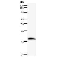ZSCAN21 / Zipro1 Antibody (clone 3418F1a)