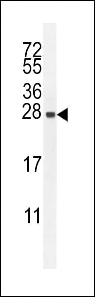 IRGM / LRG-47 Antibody (aa151-179)