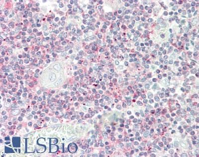 IHC-plus™ Polyclonal Rabbit anti-Human SEPT6 / Septin 6 Antibody (aa208-257, IHC, WB)
