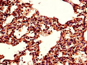 TPI1 / TPI Antibody