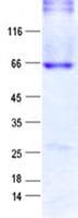 Human LHX9 Protein (Recombinant GST, N-terminus + His, C-terminus)