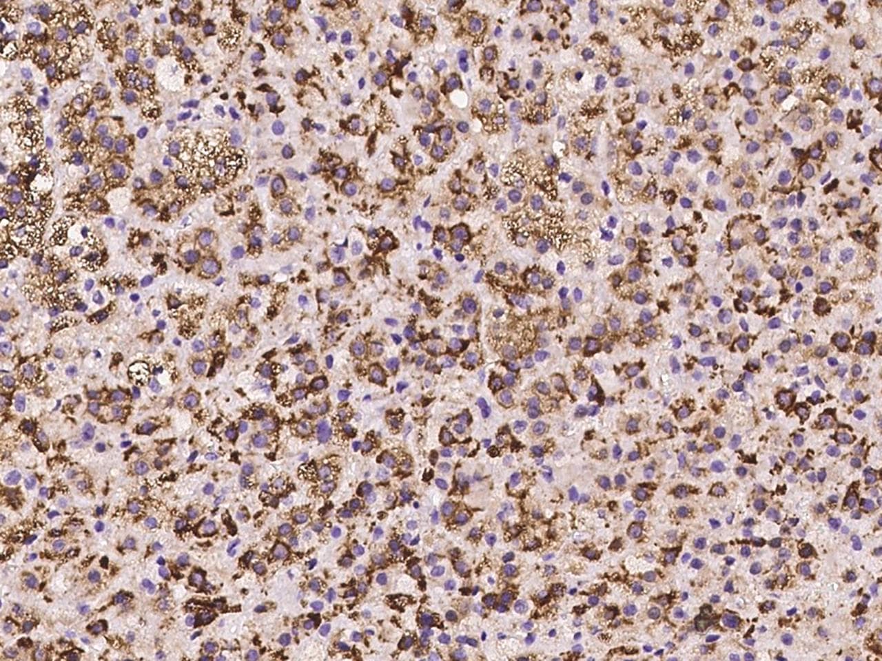 PLIN3 / M6PRBP1 / TIP47 Antibody