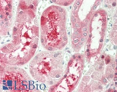 IHC-plus™ Polyclonal Rabbit anti-Human PTGR1 / LTB4DH Antibody (aa75-124, IHC, WB)