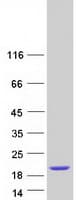 Human CCDC153 Protein (Recombinant Myc-DDK (Flag))