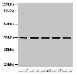 Polyclonal Rabbit anti-Human RHBDL2 / RRP2 Antibody (WB)