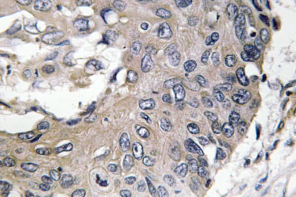 APOE / Apolipoprotein E Antibody (Met86)