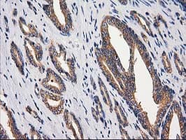 GBA3 / CBG Antibody (clone OTI1F1)