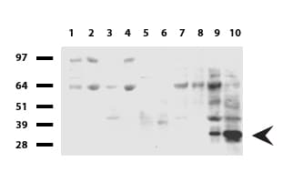 CD20 Antibody (clone UMAB58, Carrier-free)