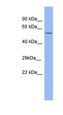 RRAD Antibody (aa143-192)