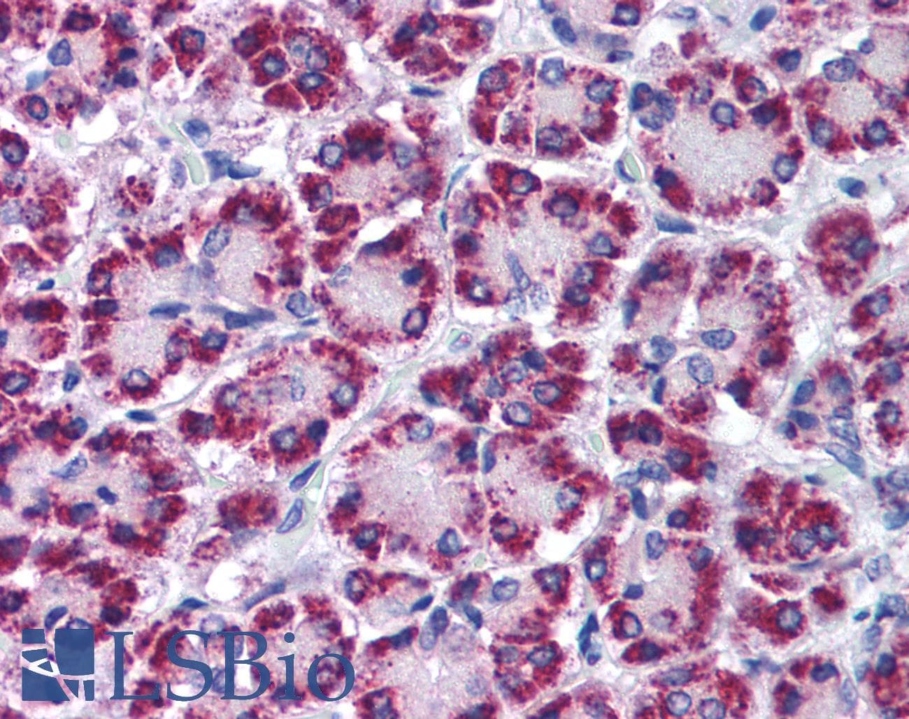 IHC-plus™ Polyclonal Rabbit anti-Human MAPKAP1 / MIP1 Antibody (IHC, WB)