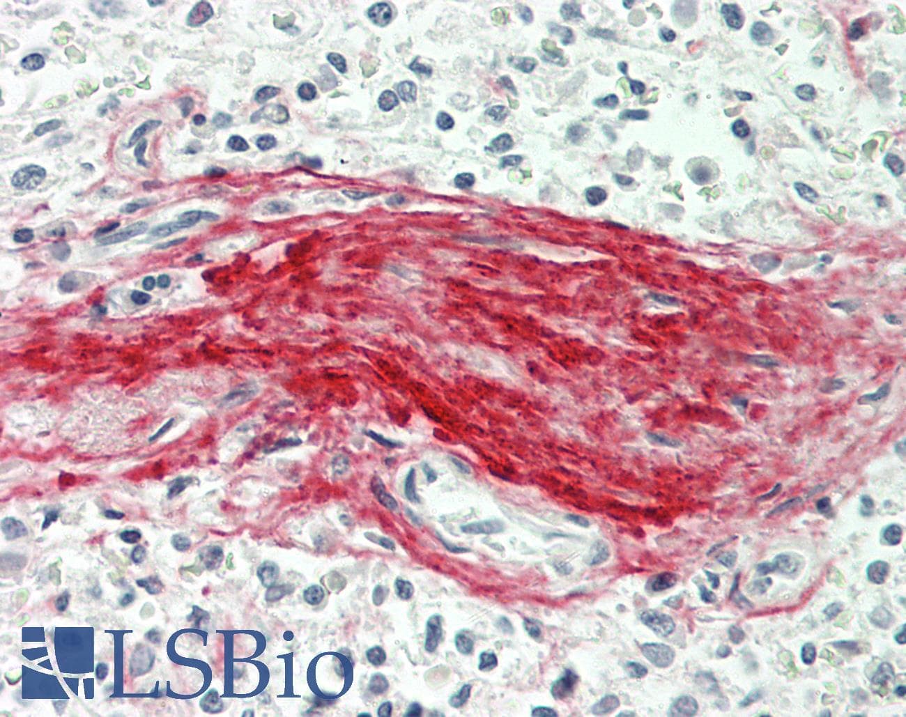 BGN / Biglycan Antibody (aa53-166)