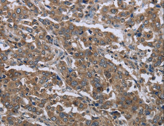 Polyclonal Rabbit anti-Human GGCX Antibody (IHC, WB)