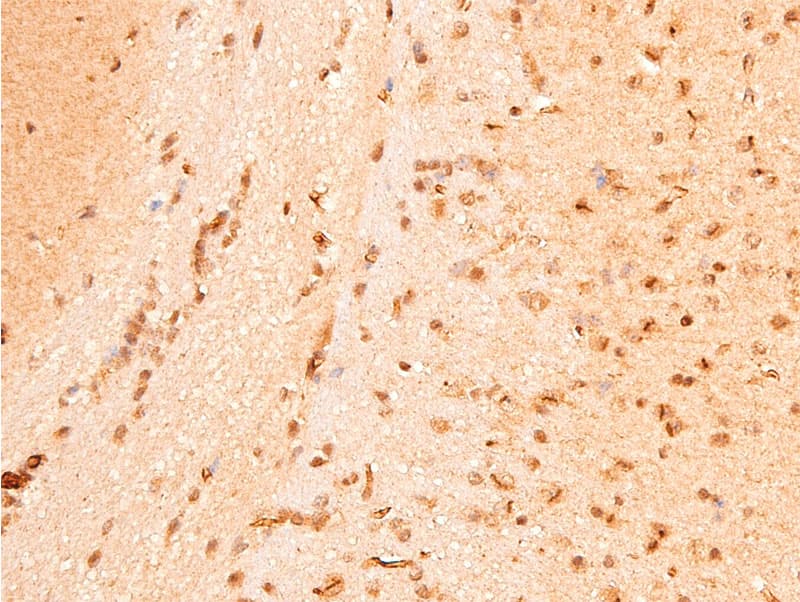 Polyclonal Rabbit anti-Human CHEK1 / CHK1 Antibody (phospho-Ser296, IHC, IF, WB)