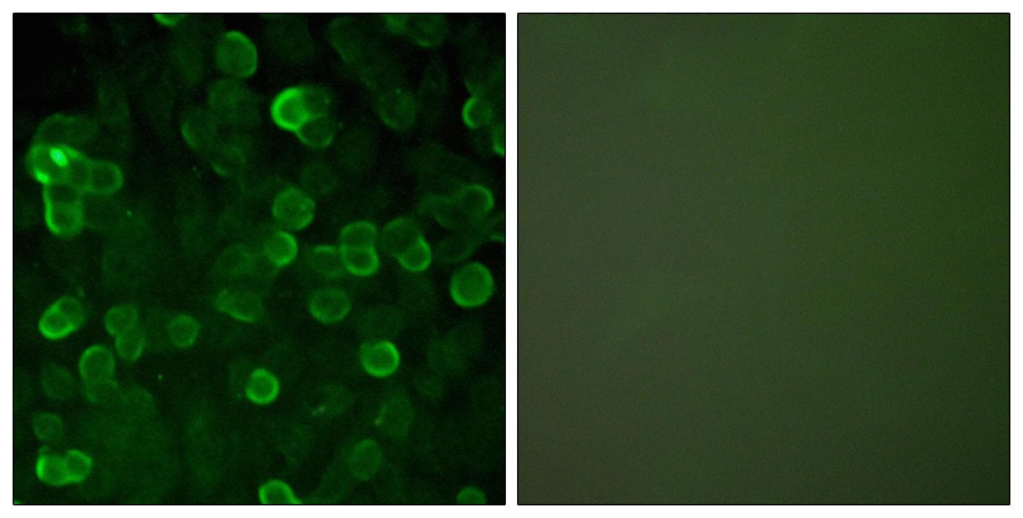 CDH1 / E Cadherin Antibody