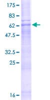 Human ZDHHC23 Protein (Recombinant GST)