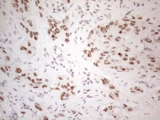 IRS1 Antibody (aa1-280, clone OTI2B10)