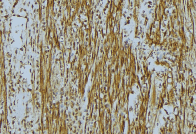WASF2 / SCAR2 Antibody